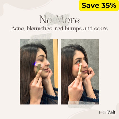 4 - in - 1 Skincare Wand - Harkali